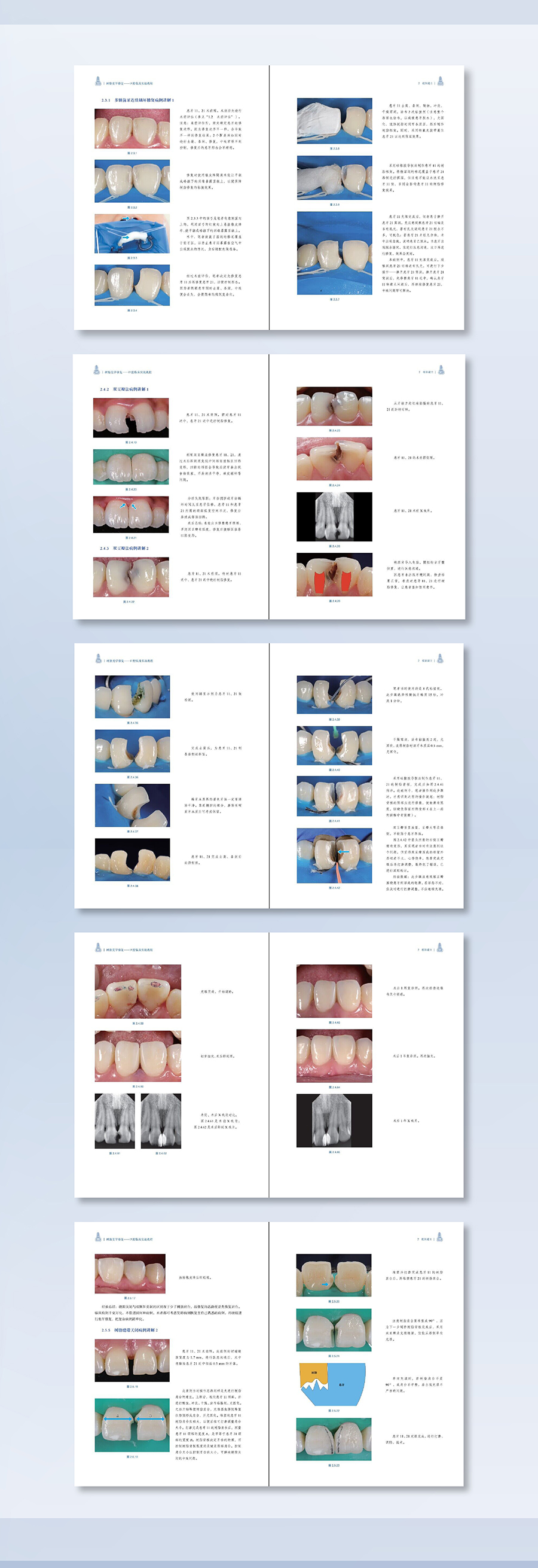 1699439714149667.jpg 详情-03.jpg