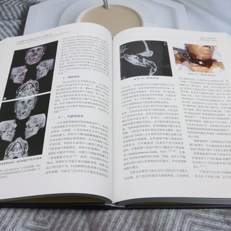 【口腔頜面外科併發症預防與治療】(原著第2版) 【口腔頜面外科併發症預防與治療】(原著第2版)