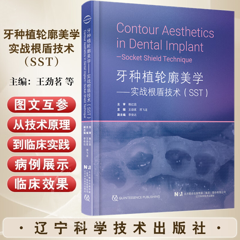 【牙種植輪廓美學——實戰根盾科技SST】 【牙種植輪廓美學——實戰根盾科技SST】